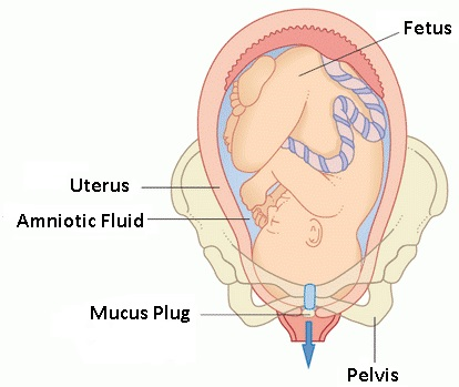 mucus plug