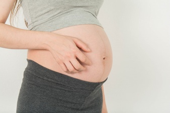 perut gatal saat hamil
