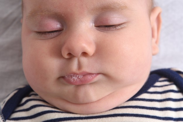 bibir bayi pucat