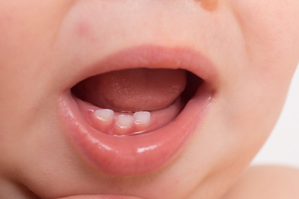 sakit gigi gusi bengkak pada anak apa obatnya 13