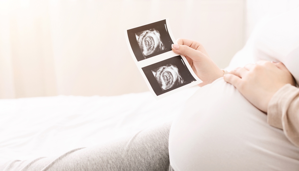 posisi janin, diary bunda