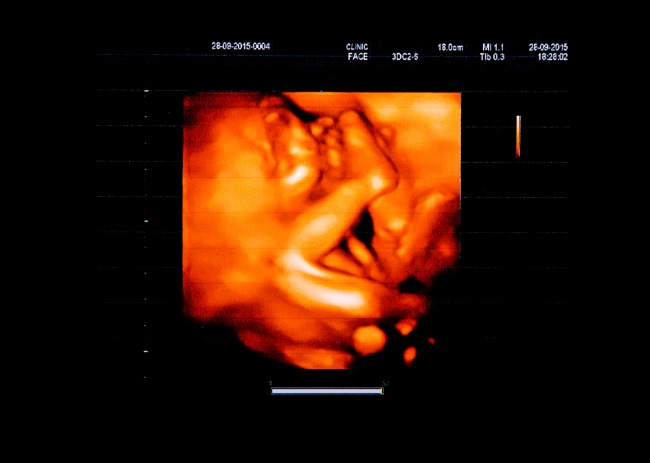 bentuk janin 5 bulan, diary bunda