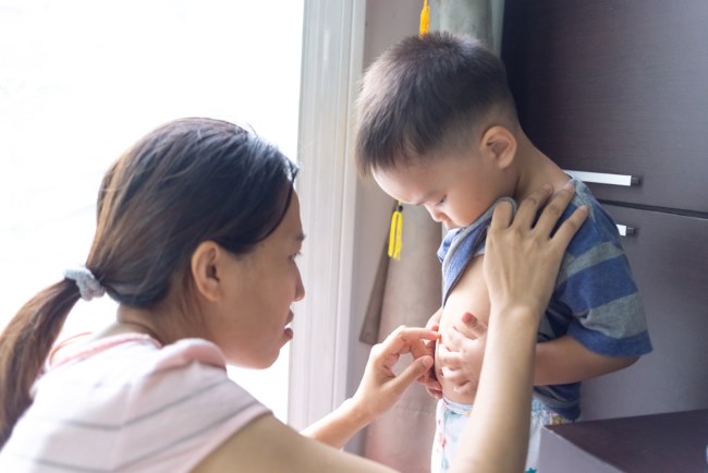 mengatasi perut kembung pada anak usia 4 tahun, diary bunda